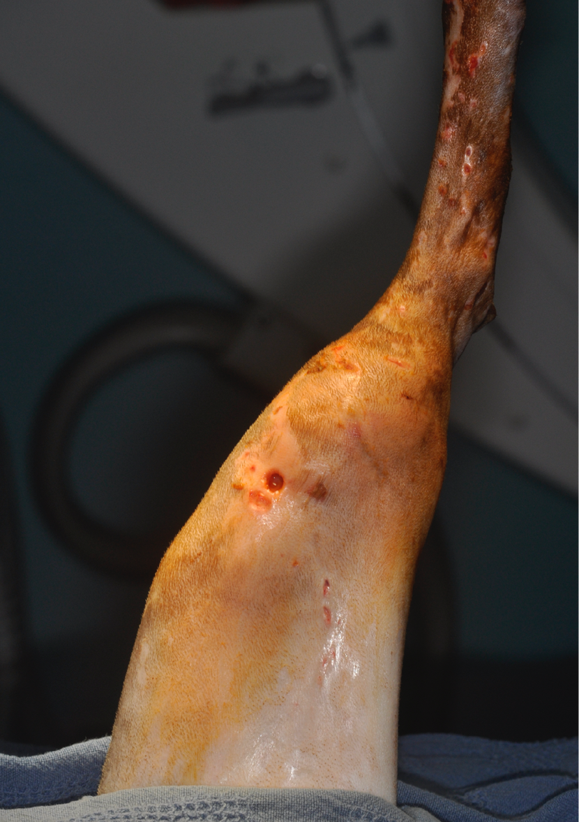 Open Septic Tibial Fracture — Cat