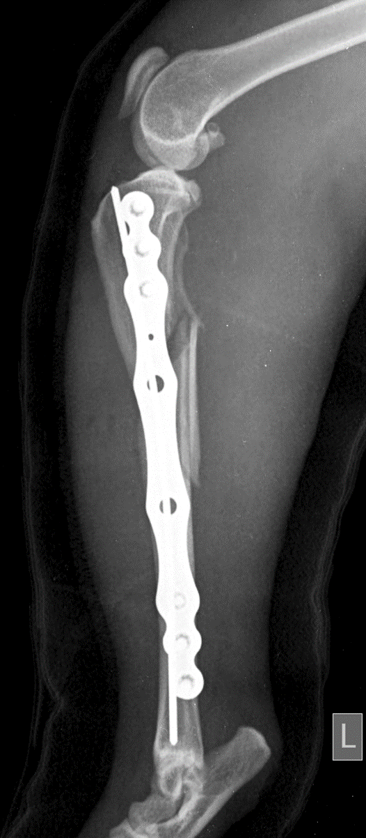 Post-operative radiograph — left view