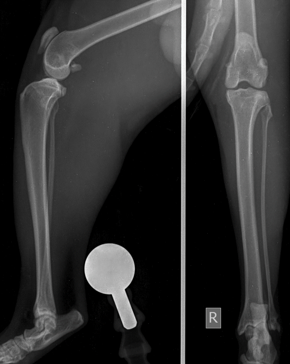 Post-operative radiograph — lateral view