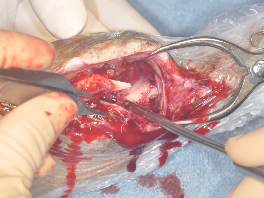 Intraoperative view of the open fracture site