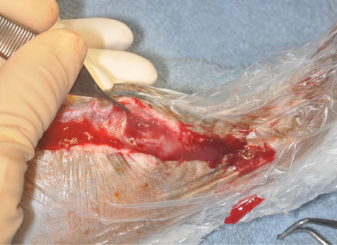Purulent discharge visible at fracture site