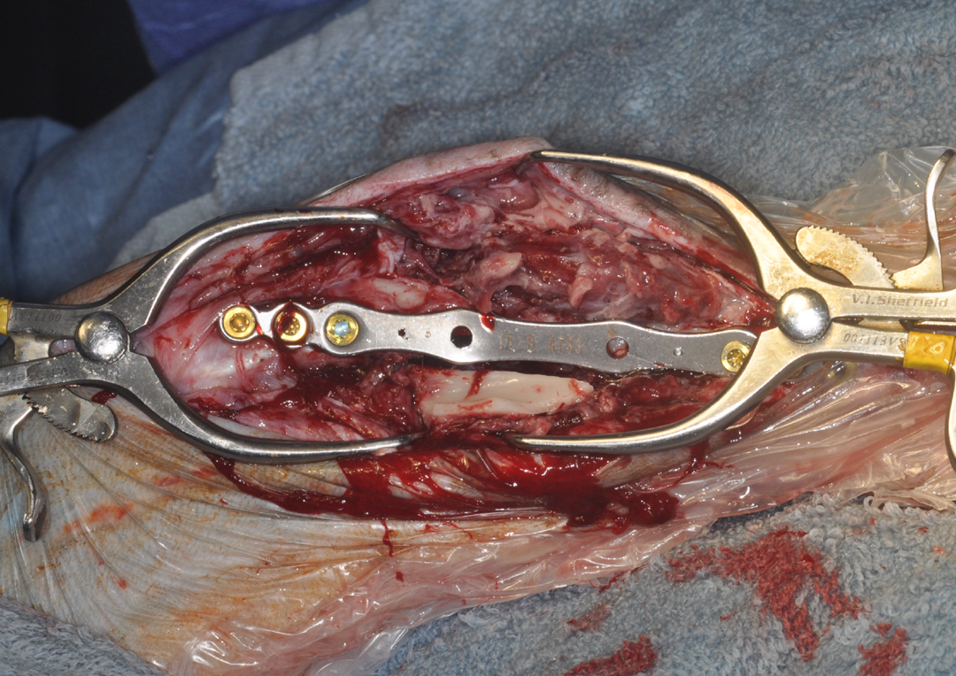 Post-Simini application view of the wound