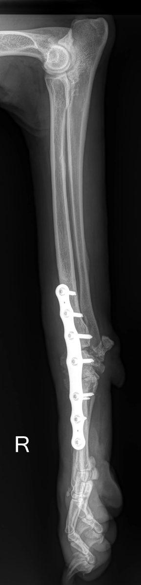 Post-operative radiograph showing LCP pancarpal arthrodesis plate in situ