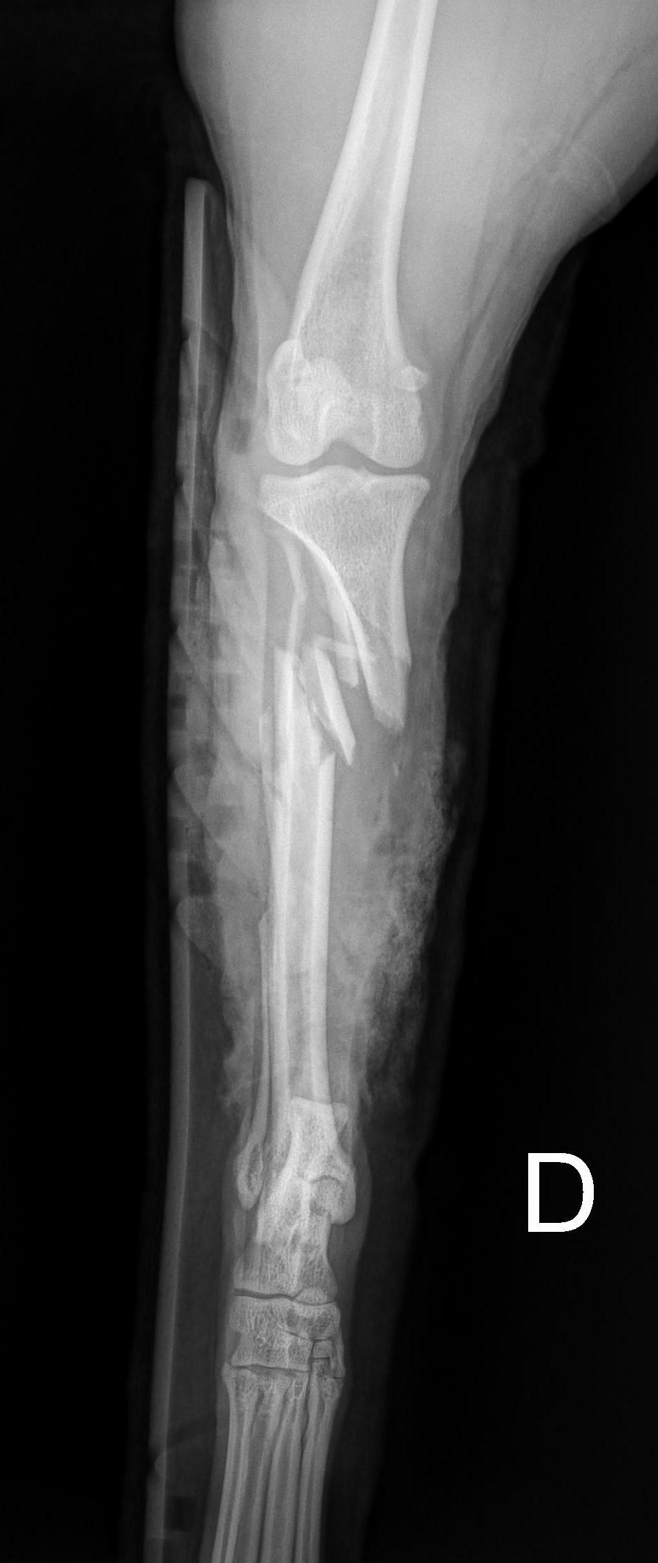 Post-operative radiograph showing LC-DCP plate fixation