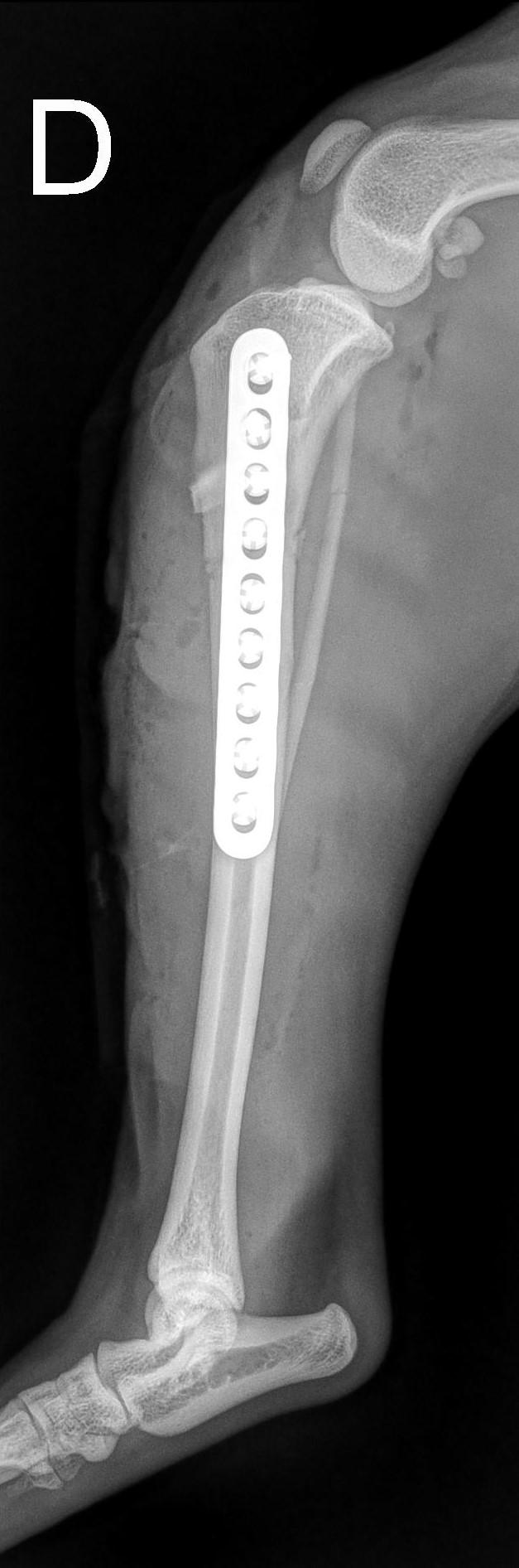 2-week follow-up — wound fully healed