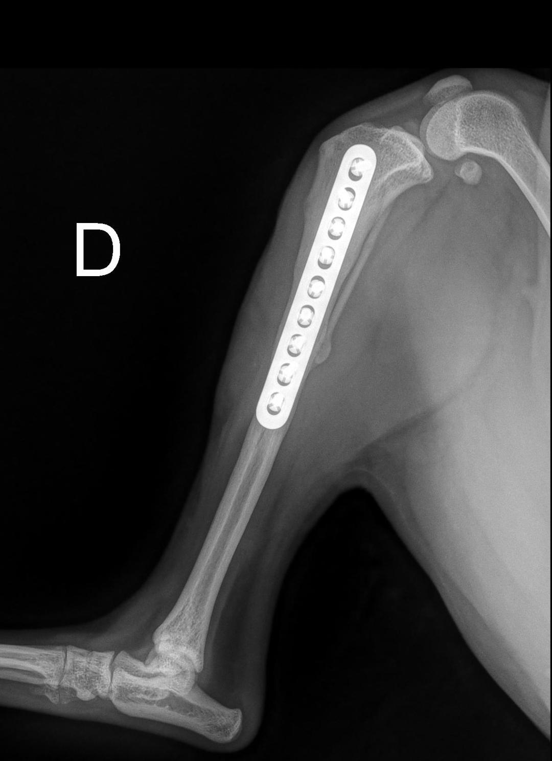 6-month follow-up — full recovery confirmed