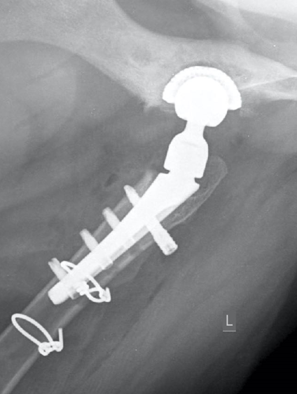 Follow-up radiograph right
