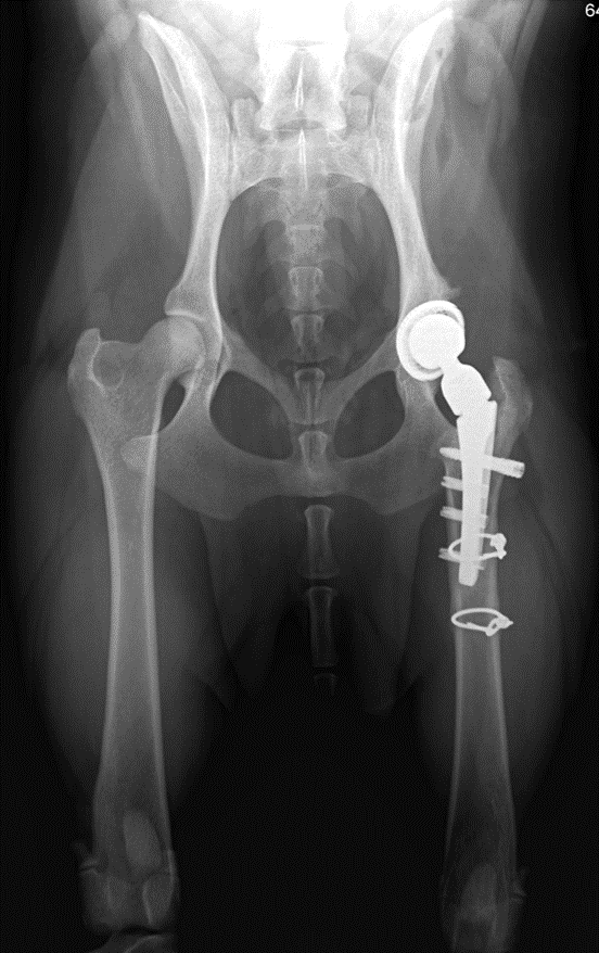 3-month follow-up radiograph right