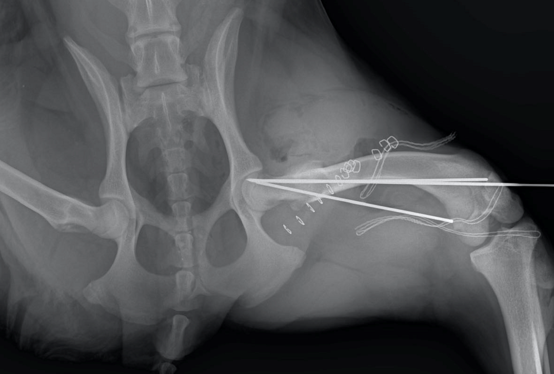 Pre-operative radiograph right view