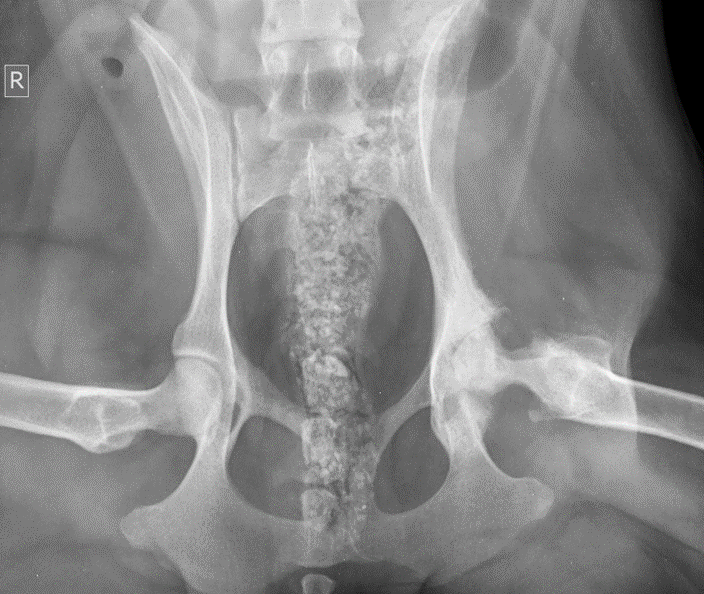 Intraoperative image — hip preparation