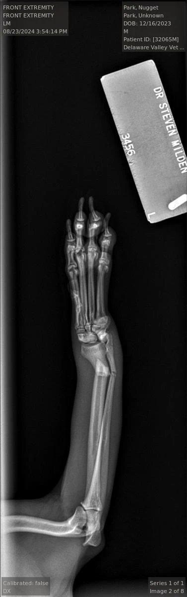 Pre-operative radiograph, lateral view