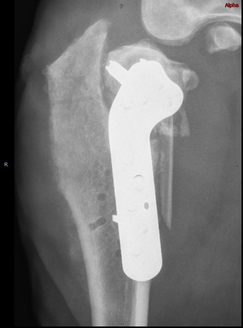 Further radiographic assessment confirming non-union