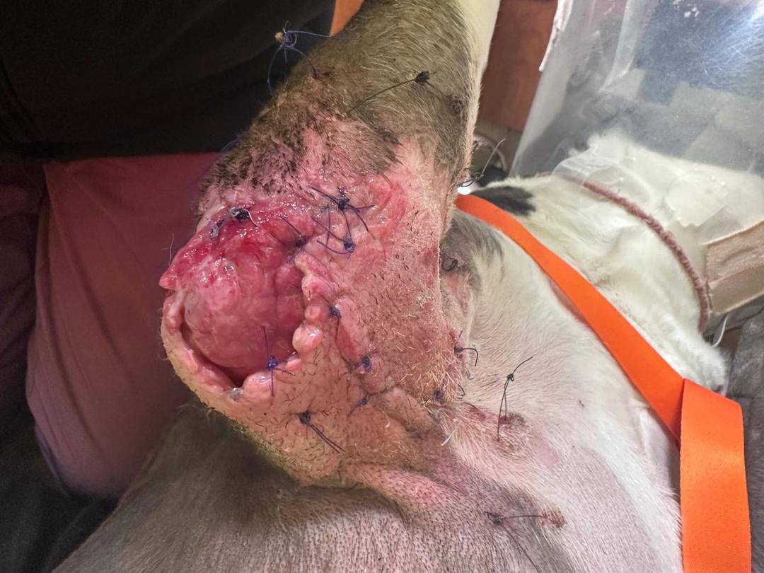 Wound dehiscence at elbow sarcoma excision site showing exposed tissue and sutures