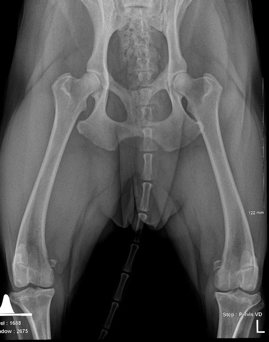 Pre-operative pelvis VD radiograph
